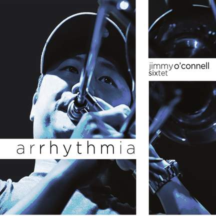 Arrhythmia