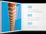 D'Addario: XS Phosphor Bronze Product Image