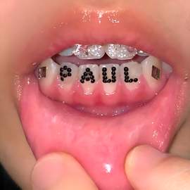 Smiling Through the Pain 2