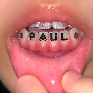 Smiling Through the Pain 2