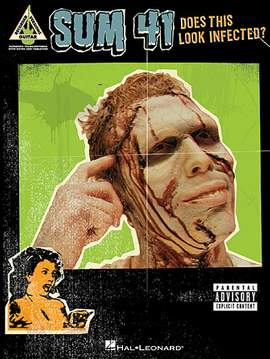 Sum 41: No Brains
